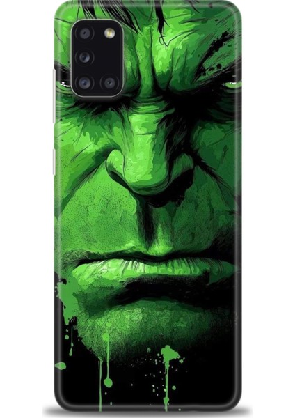Samsung Galaxy A31 Hd Baskılı Kılıf + Seramik Tam Kaplayan Ekran Koruyucu 94