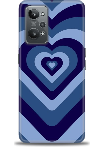 Realme Gt2 Kılıf Hd Baskılı Kılıf + Seramik Tam Kaplayan Ekran Koruyucu 199