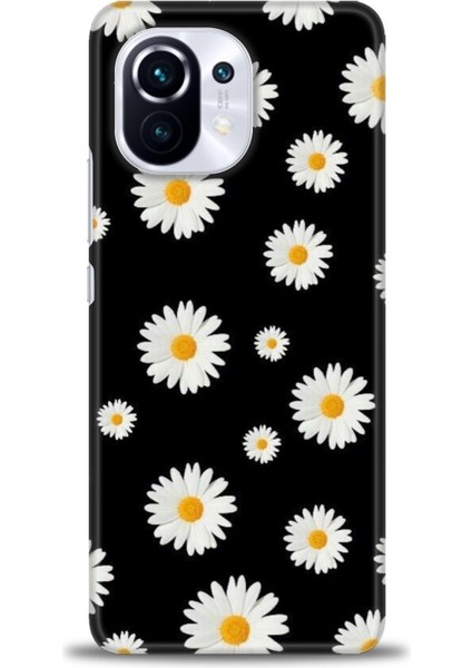 Xiaomi Mi 11 Kılıf Hd Baskılı Kılıf + Seramik Tam Kaplayan Ekran Koruyucu 135