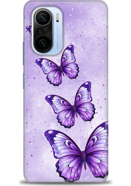 Xiaomi Mi 11I Kılıf Hd Baskılı Kılıf + Seramik Tam Kaplayan Ekran Koruyucu 296