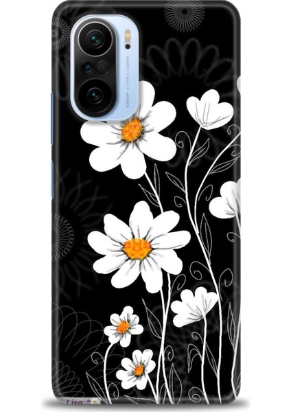 Xiaomi Mi 11I Kılıf Hd Baskılı Kılıf + Seramik Tam Kaplayan Ekran Koruyucu 133
