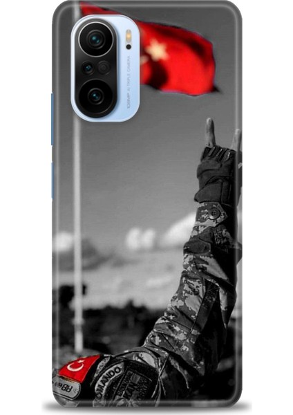 Xiaomi Mi 11I Kılıf Hd Baskılı Kılıf + Seramik Tam Kaplayan Ekran Koruyucu 35