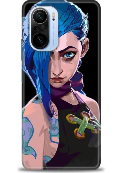 Xiaomi Mi 11I Kılıf Hd Baskılı Kılıf + Seramik Tam Kaplayan Ekran Koruyucu 271