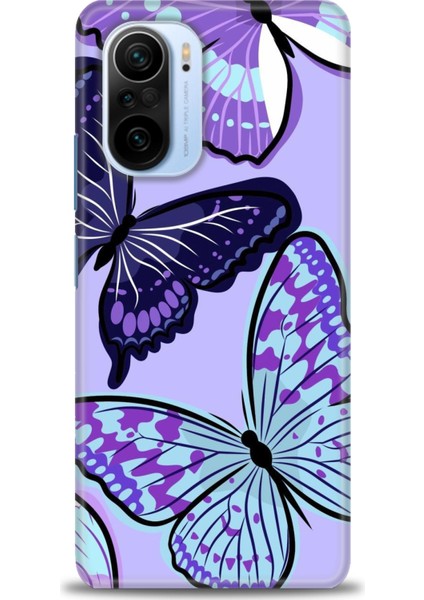 Xiaomi Mi 11I Kılıf Hd Baskılı Kılıf + Seramik Tam Kaplayan Ekran Koruyucu 295