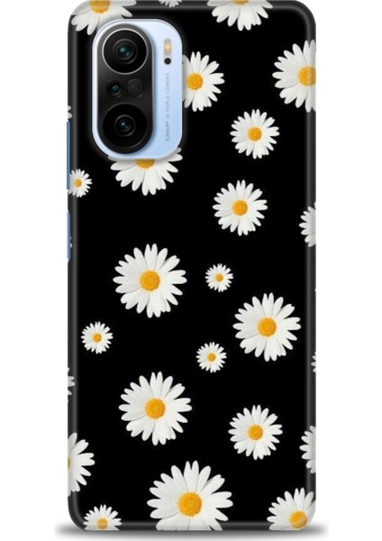 Xiaomi Mi 11I Kılıf Hd Baskılı Kılıf + Seramik Tam Kaplayan Ekran Koruyucu 135