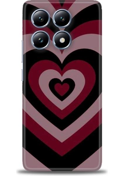 Xiaomi Mi 14T Pro Kılıf Hd Baskılı Kılıf + Seramik Tam Kaplayan Ekran Koruyucu 191