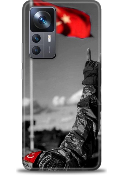 Xiaomi Mi 12T Pro Kılıf Hd Baskılı Kılıf + Seramik Tam Kaplayan Ekran Koruyucu 35