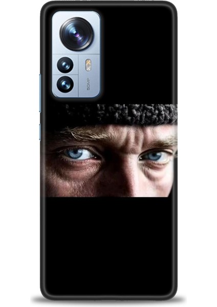 Xiaomi Mi 12 Pro Kılıf Hd Baskılı Kılıf + Seramik Tam Kaplayan Ekran Koruyucu 28