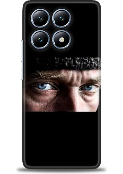 Xiaomi Mi 14T Pro Kılıf Hd Baskılı Kılıf + Seramik Tam Kaplayan Ekran Koruyucu 28