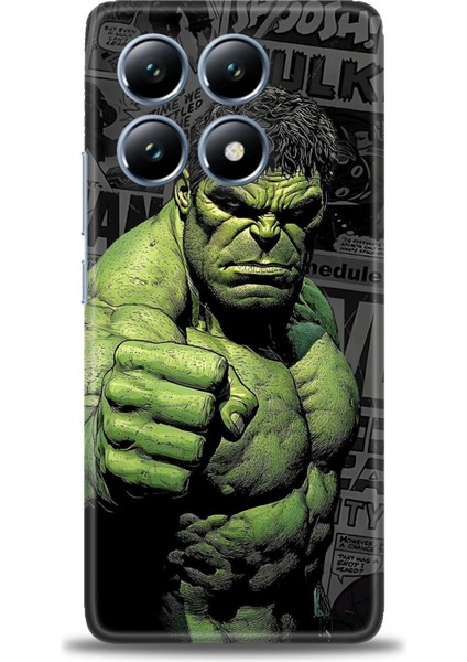 Xiaomi Mi 14T Pro Kılıf Hd Baskılı Kılıf + Seramik Tam Kaplayan Ekran Koruyucu 97