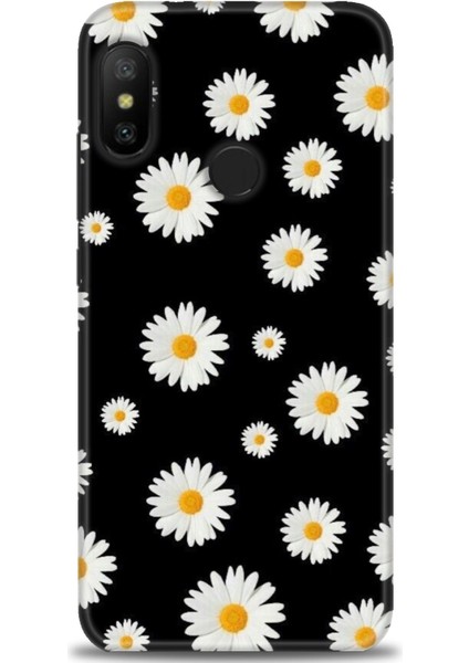 Xiaomi Mi A2 Lite Kılıf Hd Baskılı Kılıf + Seramik Tam Kaplayan Ekran Koruyucu 135
