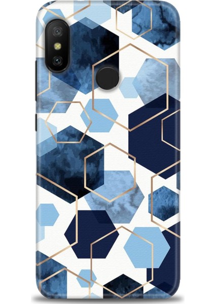 Xiaomi Mi A2 Lite Kılıf Hd Baskılı Kılıf + Seramik Tam Kaplayan Ekran Koruyucu 324