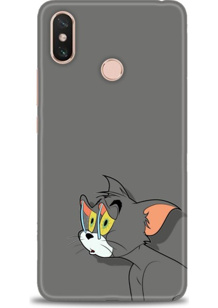 Xiaomi Mi Max 3 Kılıf Hd Baskılı Kılıf + Seramik Tam Kaplayan Ekran Koruyucu 408