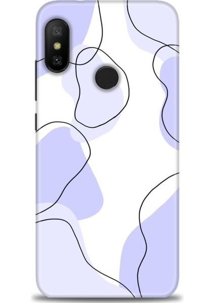 Xiaomi Mi A2 Lite Kılıf Hd Baskılı Kılıf + Seramik Tam Kaplayan Ekran Koruyucu 178