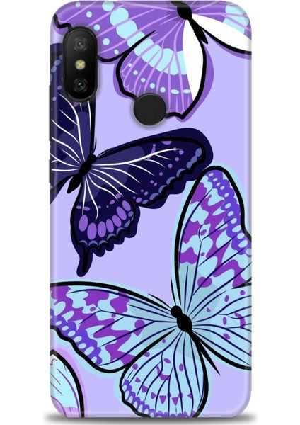 Xiaomi Mi A2 Lite Kılıf Hd Baskılı Kılıf + Seramik Tam Kaplayan Ekran Koruyucu 295