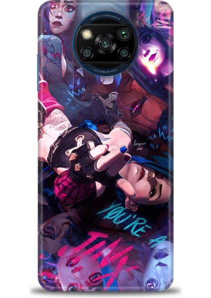 Xiaomi Poco X3 Nfc Kılıf Hd Baskılı Kılıf + Seramik Tam Kaplayan Ekran Koruyucu 278