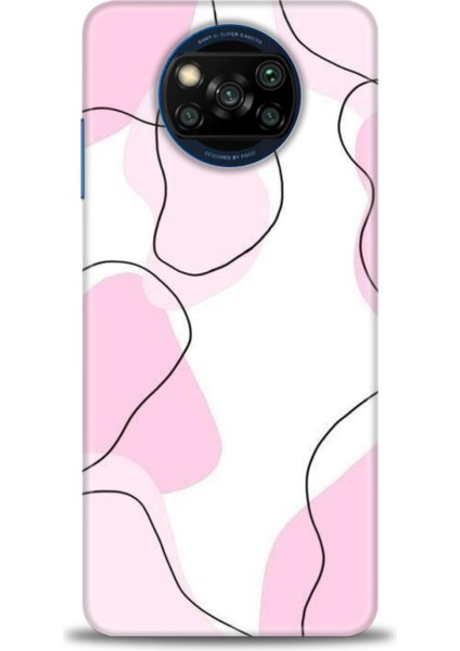 Xiaomi Poco X3 Nfc Kılıf Hd Baskılı Kılıf + Seramik Tam Kaplayan Ekran Koruyucu 171