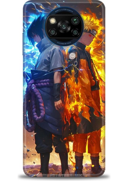 Xiaomi Poco X3 Nfc Kılıf Hd Baskılı Kılıf + Seramik Tam Kaplayan Ekran Koruyucu 260