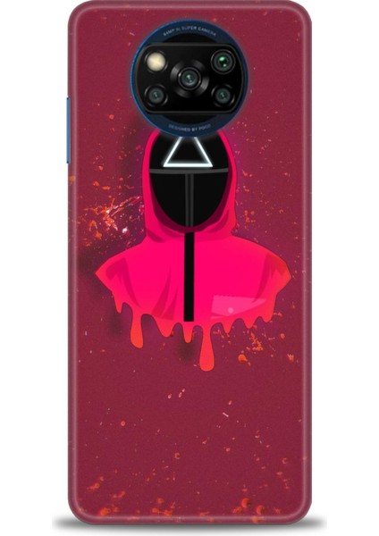 Xiaomi Poco X3 Pro Kılıf Hd Baskılı Kılıf + Seramik Tam Kaplayan Ekran Koruyucu 287