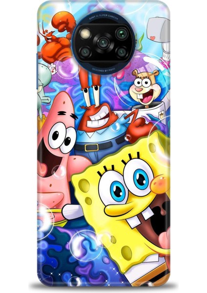 Xiaomi Poco X3 Nfc Kılıf Hd Baskılı Kılıf + Seramik Tam Kaplayan Ekran Koruyucu 455