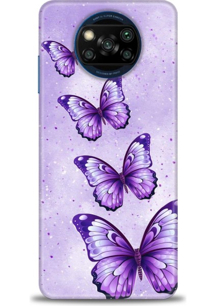 Xiaomi Poco X3 Nfc Kılıf Hd Baskılı Kılıf + Seramik Tam Kaplayan Ekran Koruyucu 296