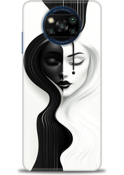 Xiaomi Poco X3 Nfc Kılıf Hd Baskılı Kılıf + Seramik Tam Kaplayan Ekran Koruyucu 144