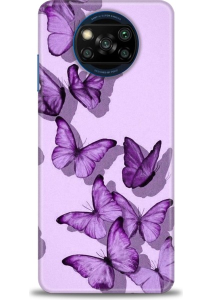 Xiaomi Poco X3 Pro Kılıf Hd Baskılı Kılıf + Seramik Tam Kaplayan Ekran Koruyucu 300