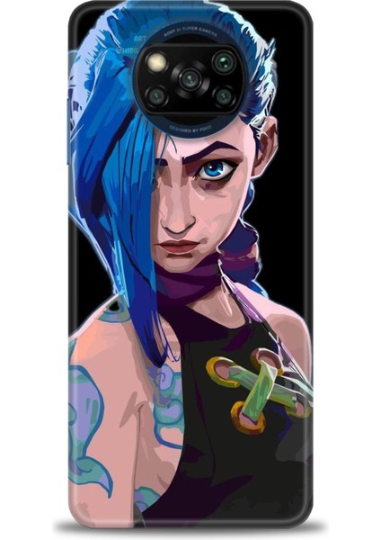 Xiaomi Poco X3 Nfc Kılıf Hd Baskılı Kılıf + Seramik Tam Kaplayan Ekran Koruyucu 271