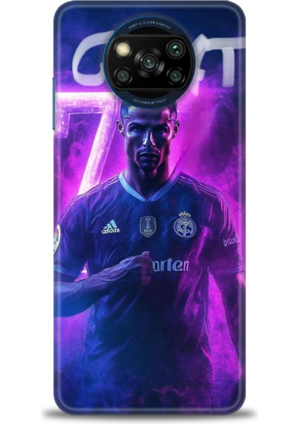 Xiaomi Poco X3 Pro Kılıf Hd Baskılı Kılıf + Seramik Tam Kaplayan Ekran Koruyucu 9