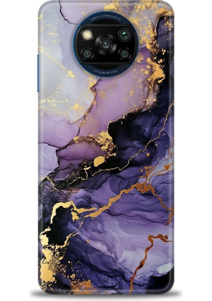 Xiaomi Poco X3 Pro Kılıf Hd Baskılı Kılıf + Seramik Tam Kaplayan Ekran Koruyucu 315