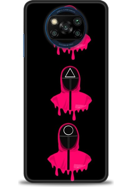 Xiaomi Poco X3 Pro Kılıf Hd Baskılı Kılıf + Seramik Tam Kaplayan Ekran Koruyucu 284