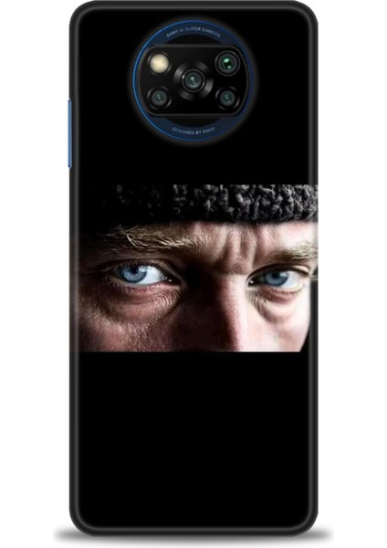 Xiaomi Poco X3 Nfc Kılıf Hd Baskılı Kılıf + Seramik Tam Kaplayan Ekran Koruyucu 28
