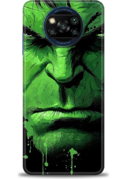 Xiaomi Poco X3 Pro Kılıf Hd Baskılı Kılıf + Seramik Tam Kaplayan Ekran Koruyucu 94