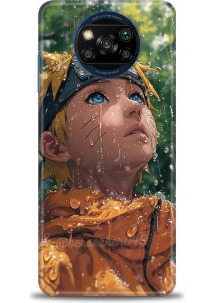 Xiaomi Poco X3 Pro Kılıf Hd Baskılı Kılıf + Seramik Tam Kaplayan Ekran Koruyucu 257