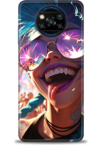 Xiaomi Poco X3 Nfc Kılıf Hd Baskılı Kılıf + Seramik Tam Kaplayan Ekran Koruyucu 273