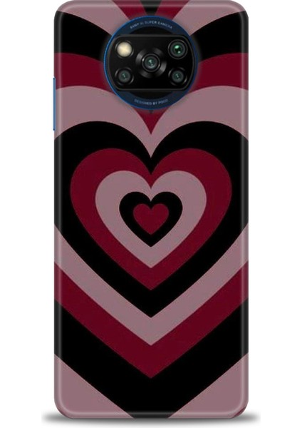 Xiaomi Poco X3 Pro Kılıf Hd Baskılı Kılıf + Seramik Tam Kaplayan Ekran Koruyucu 191