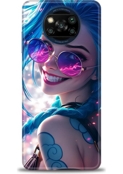 Xiaomi Poco X3 Nfc Kılıf Hd Baskılı Kılıf + Seramik Tam Kaplayan Ekran Koruyucu 274
