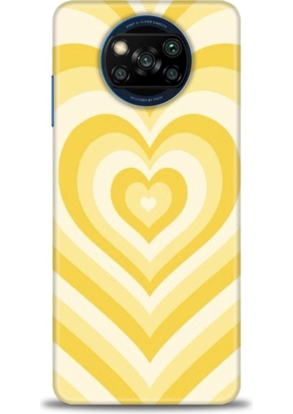 Xiaomi Poco X3 Nfc Kılıf Hd Baskılı Kılıf + Seramik Tam Kaplayan Ekran Koruyucu 197