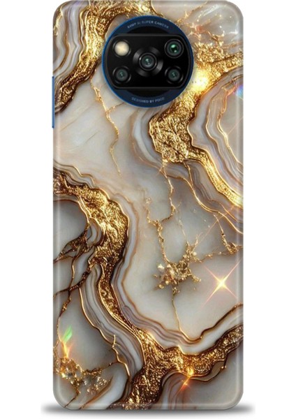 Xiaomi Poco X3 Nfc Kılıf Hd Baskılı Kılıf + Seramik Tam Kaplayan Ekran Koruyucu 313