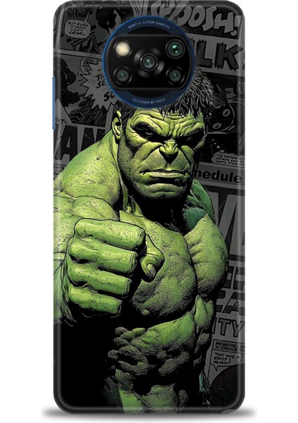 Xiaomi Poco X3 Nfc Kılıf Hd Baskılı Kılıf + Seramik Tam Kaplayan Ekran Koruyucu 97