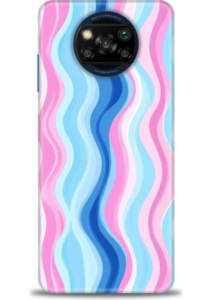 Xiaomi Poco X3 Nfc Kılıf Hd Baskılı Kılıf + Seramik Tam Kaplayan Ekran Koruyucu 429