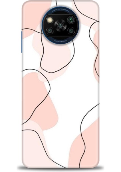 Xiaomi Poco X3 Nfc Kılıf Hd Baskılı Kılıf + Seramik Tam Kaplayan Ekran Koruyucu 180