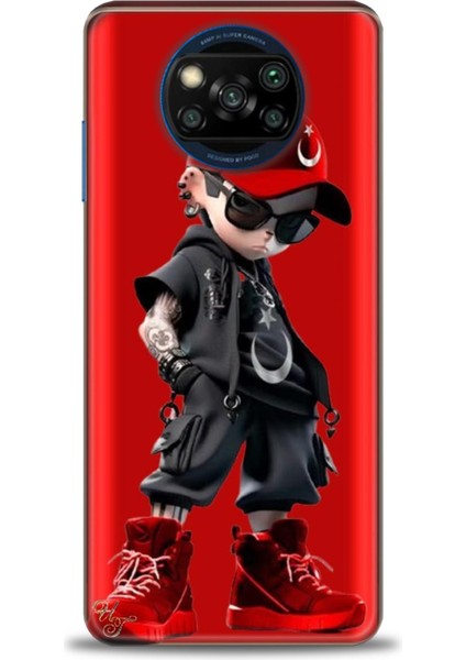 Xiaomi Poco X3 Nfc Kılıf Hd Baskılı Kılıf + Seramik Tam Kaplayan Ekran Koruyucu 250