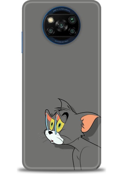 Xiaomi Poco X3 Nfc Kılıf Hd Baskılı Kılıf + Seramik Tam Kaplayan Ekran Koruyucu 408