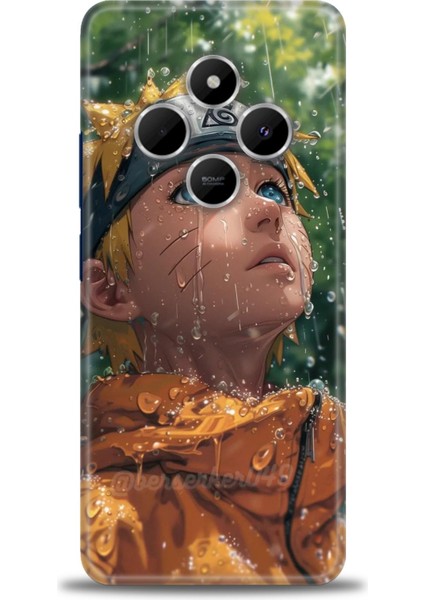Xiaomi Redmi 14C 4g Kılıf Hd Baskılı Kılıf + Seramik Tam Kaplayan Ekran Koruyucu 257
