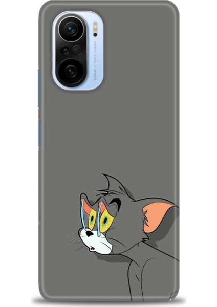 Xiaomi Redmi K40 Pro Hd Baskılı Kılıf + Seramik Tam Kaplayan Ekran Koruyucu 408