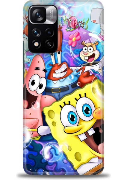 Xiaomi Redmi Note 11 Pro Plus Hd Baskılı Kılıf + Seramik Tam Kaplayan Ekran Koruyucu 455