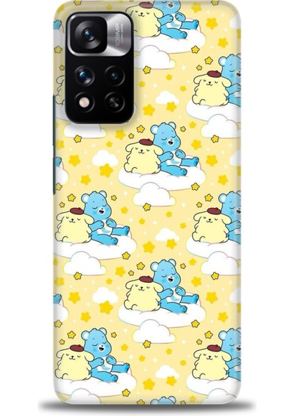 Xiaomi Redmi Note 11 Pro Plus Hd Baskılı Kılıf + Seramik Tam Kaplayan Ekran Koruyucu 495