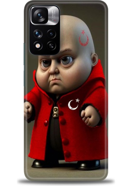 Xiaomi Redmi Note 11 Pro Plus Hd Baskılı Kılıf + Seramik Tam Kaplayan Ekran Koruyucu 245