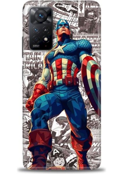 Xiaomi Redmi Note 11 Pro 4g Hd Baskılı Kılıf + Seramik Tam Kaplayan Ekran Koruyucu 91